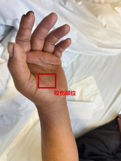 2025港澳免费资料大全和男子在湖边被蛇咬伤与男子在湖边被蛇咬伤视频